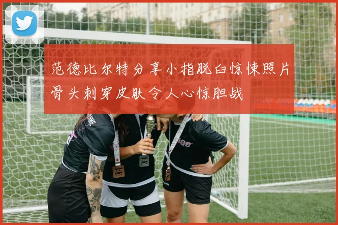 范德比尔特分享小指脱臼惊悚照片骨头刺穿皮肤令人心惊胆战